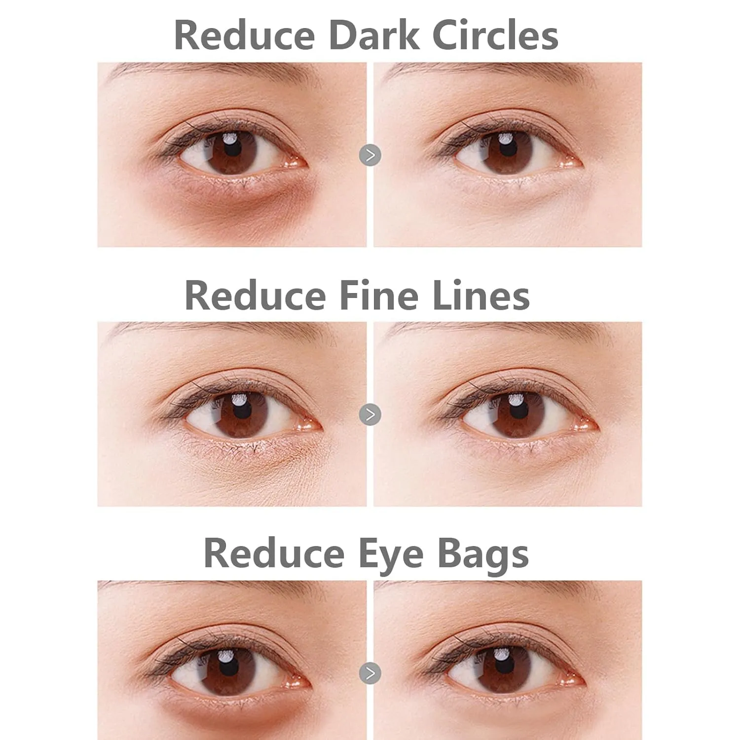 Cumabalm for Eye Bags, Cumabalm for Eyes, Erases Eye Bags, Under-Eyes Hydration, Smooths Wrinkles & Fine Lines (2 PCS)